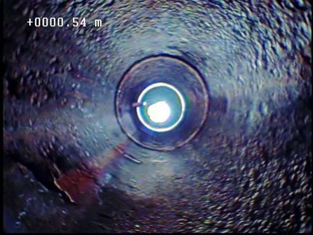 Auscultation par vidéo-caméra